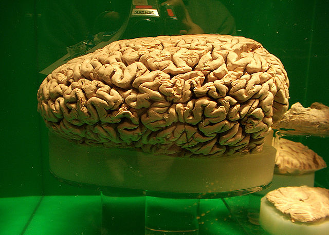 cerebro del Cachalote